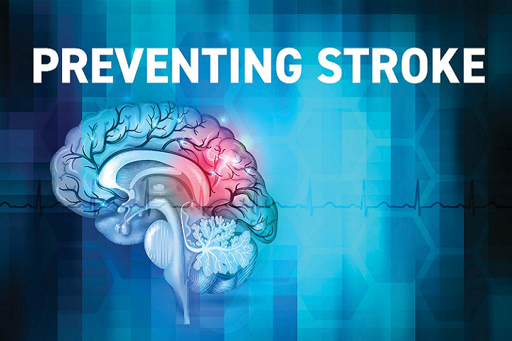 Stroke: What is it, Who is at Risk, and How Should You Take Action?
