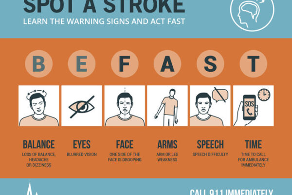 B.E.F.A.S.T. – The Essential Checklist to Identify a Stroke